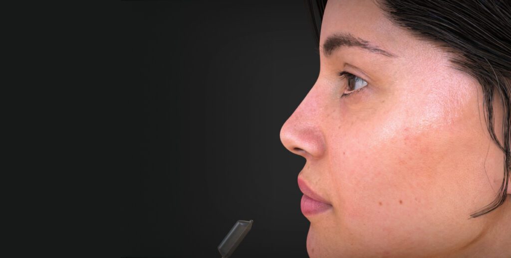 Airolign Balloon System